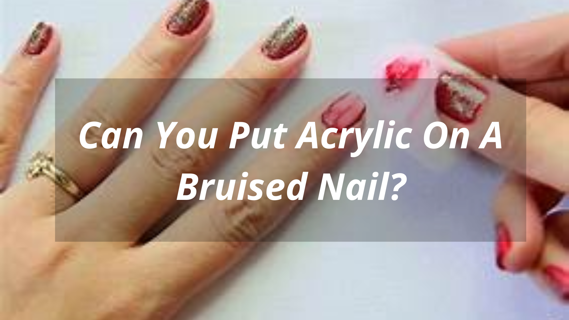 Can You Put Acrylic On A Bruised Nail?
